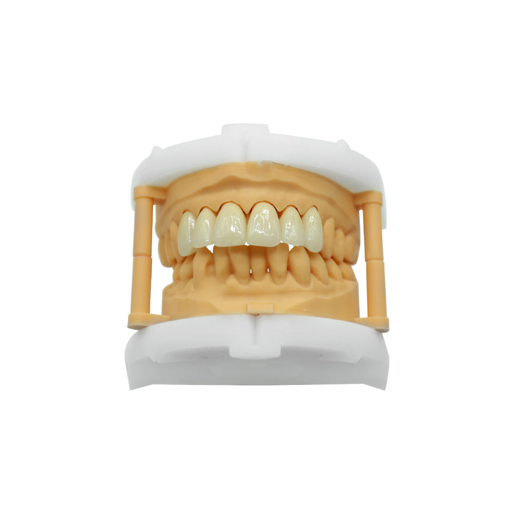Anterior Zirconia Crown And Bridge - case 2
