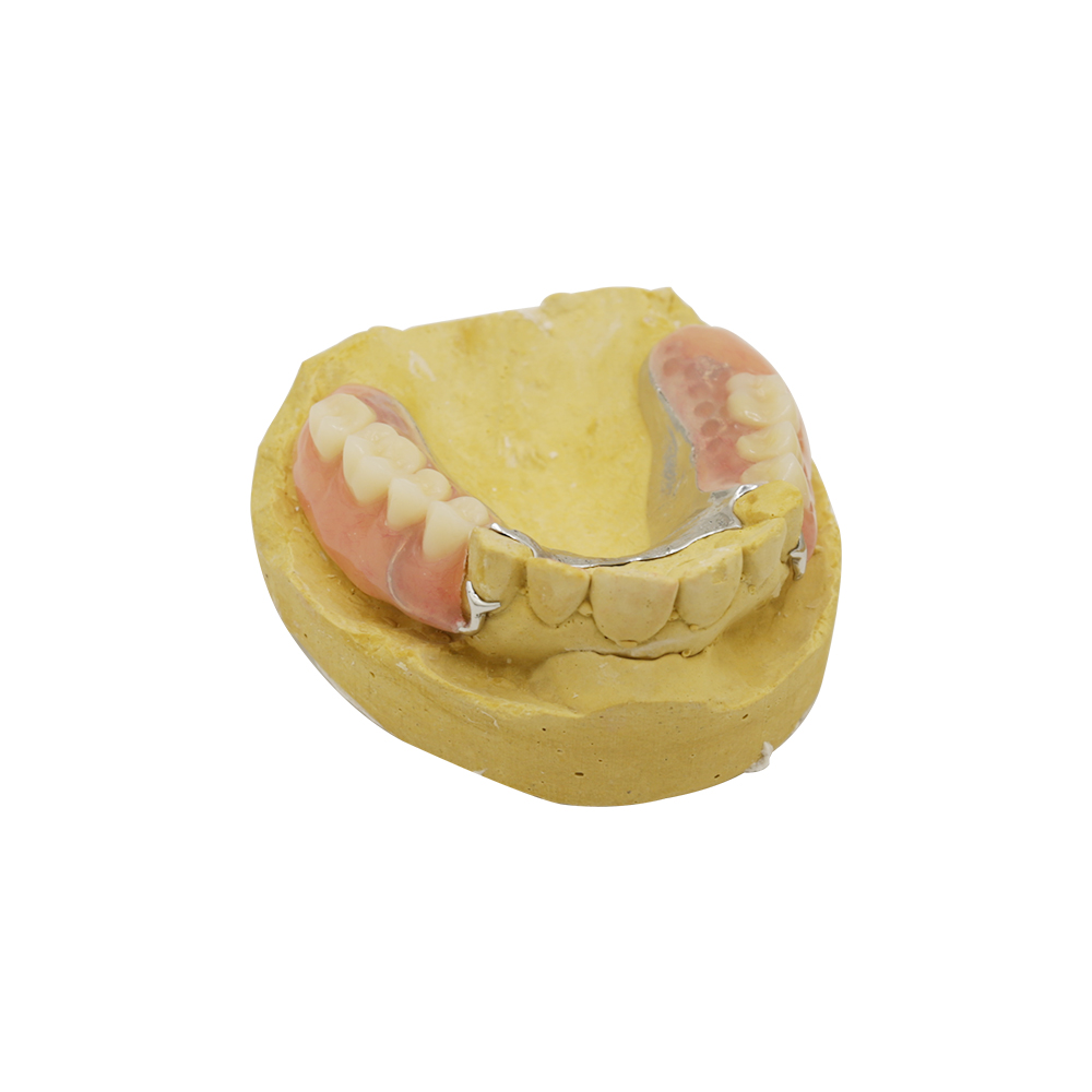 Chromium Cobalt Partial Denture, Cobalt Chrome(CoCr) Dental Plate
