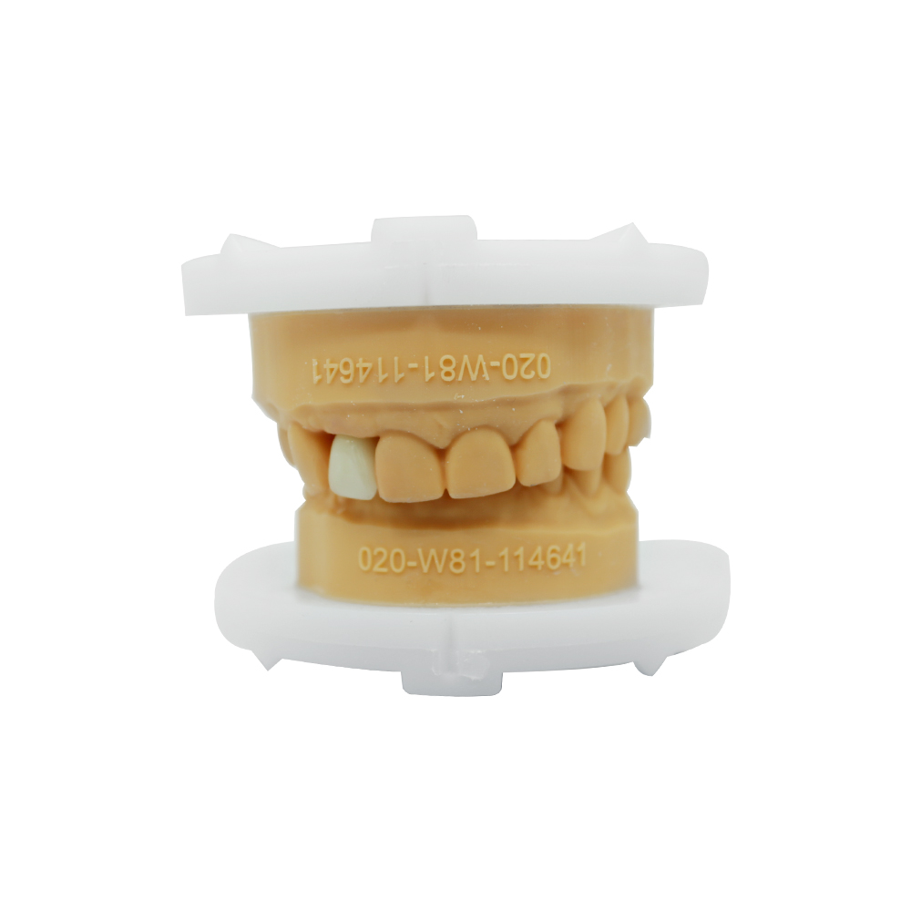Layered Zirconia Crown - case 3