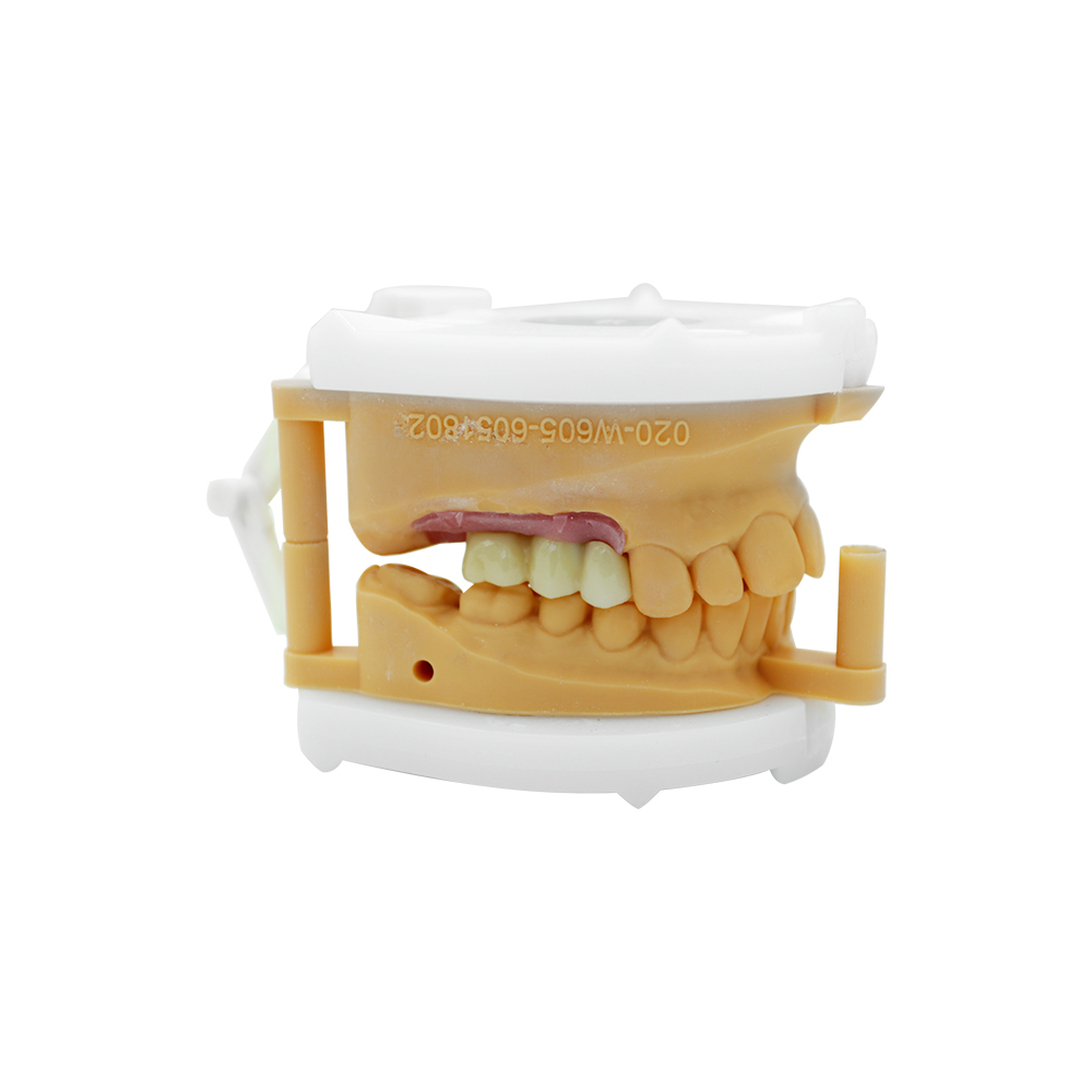 Multiple Dental Implants - case 2