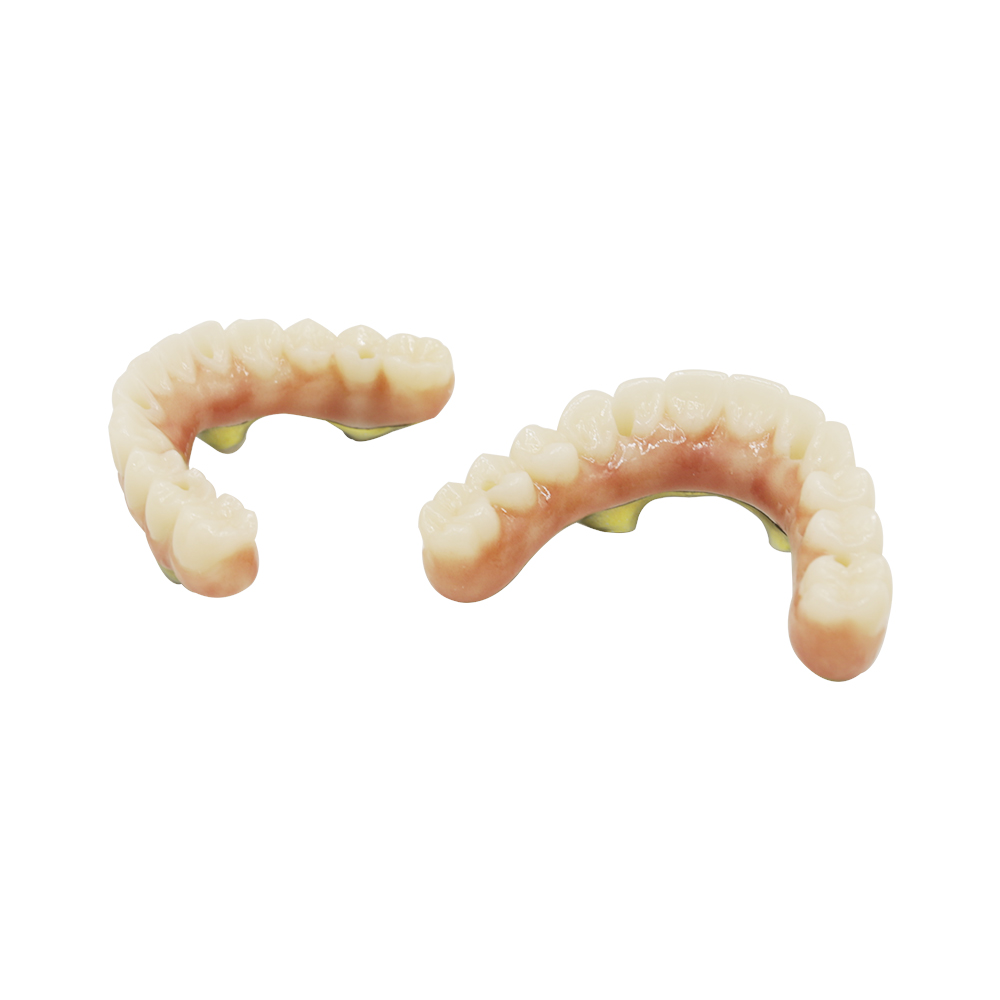 Implant Crowns - produced by Istar Dental Lab