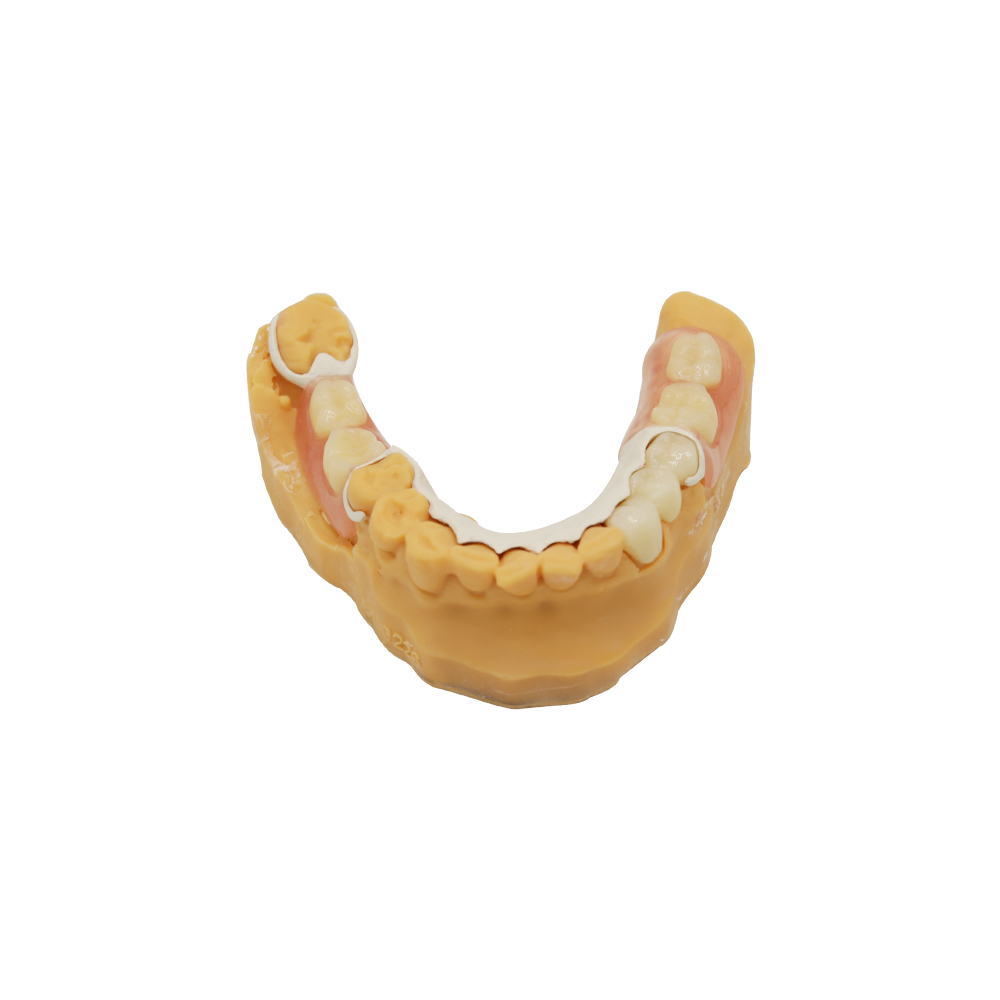 Temporary Immediate Dentures