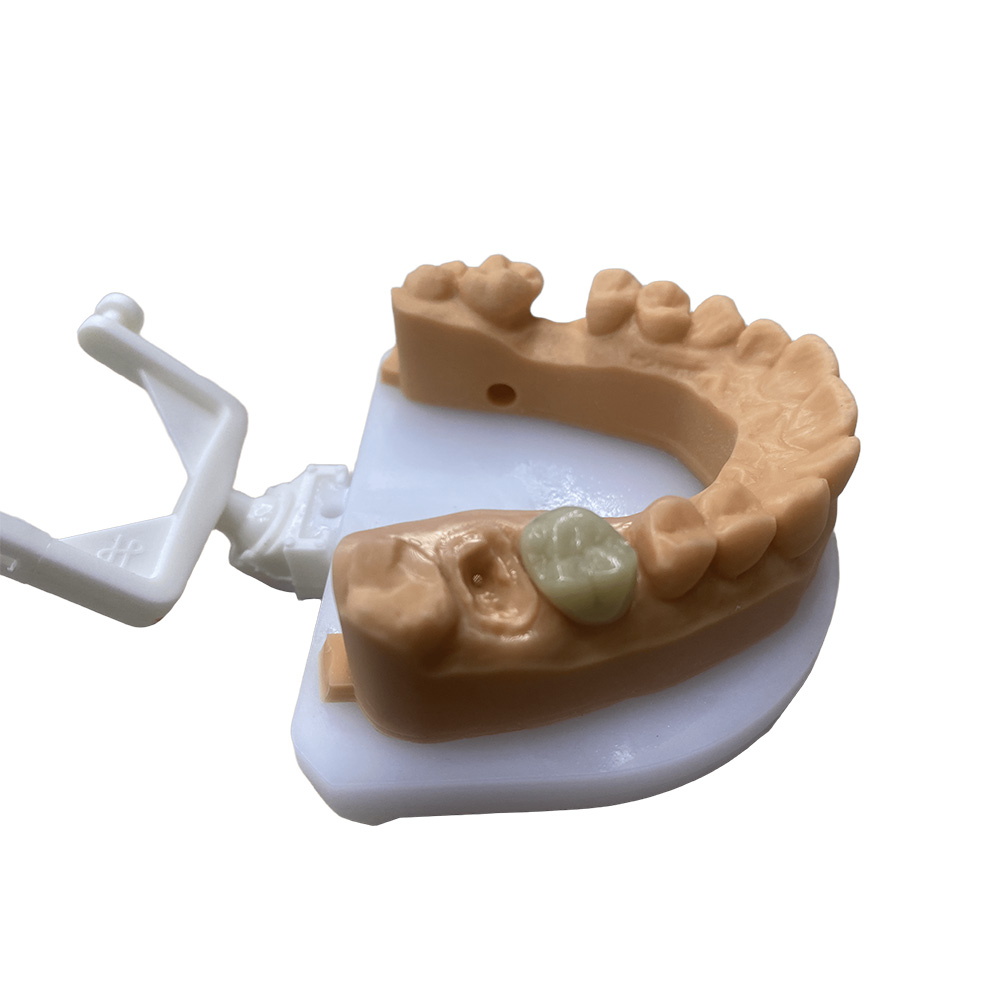 Temporary Molar Tooth