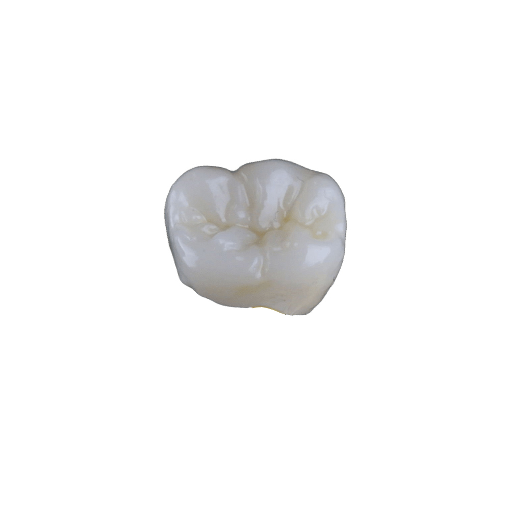 Translucent Zirconia Crowns