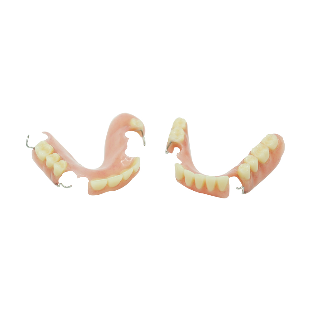 UpperLower Partial Dentures - case 2