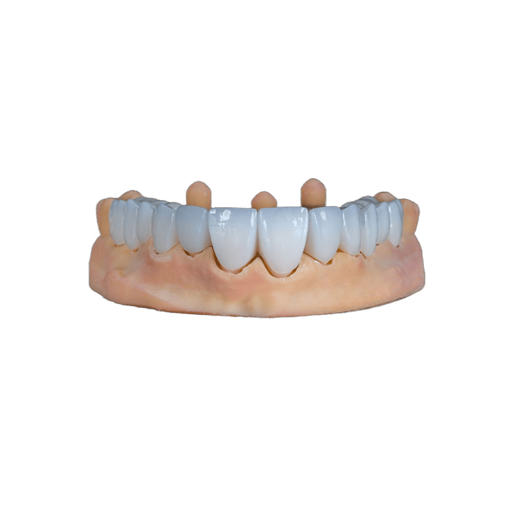 White Zirconia Crowns
